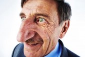 Ky është njeriu me hundën më të gjatë në botë