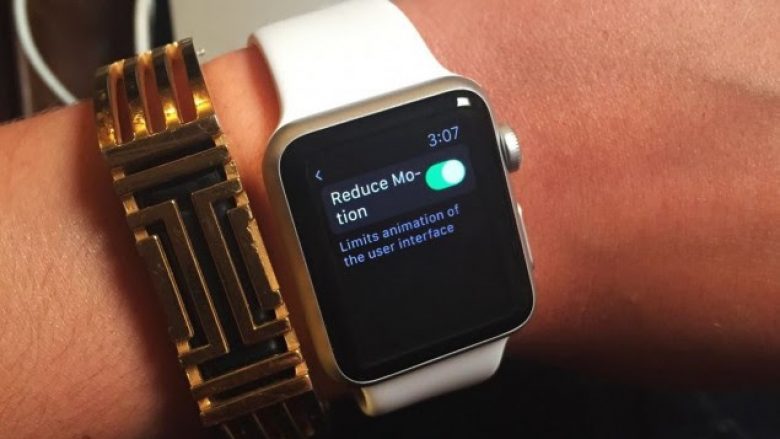 Apple Watch shpëton jetën e një 25-vjeçarje