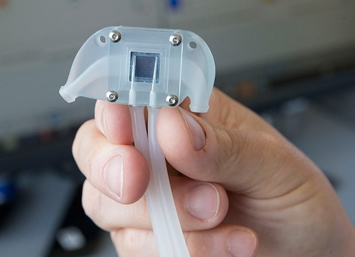 Shkencëtarët krijojnë veshkë artificiale, pritët të shpëtohen mijëra pacientë