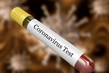 Pas orës 18:00 mësohet se a ka të prekur të tjerë me koronavirus