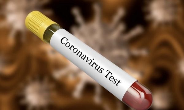 Pas orës 18:00 mësohet se a ka të prekur të tjerë me koronavirus