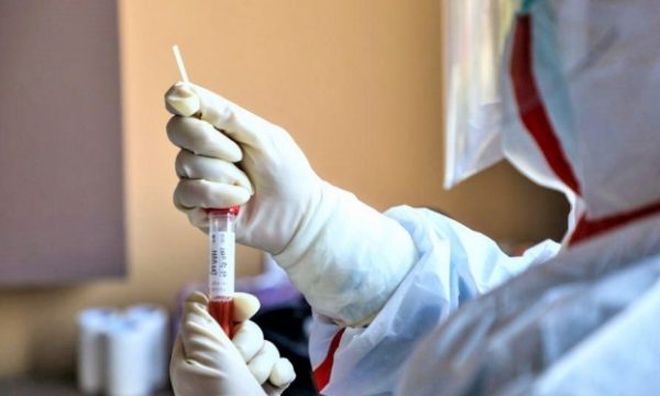 Edhe 15 raste të reja me koronavirus në Kosovë