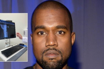 Kanye West tregon se përfundoi në spital për shkak të qëndrimit të tepërt në telefon