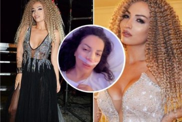 Rovena Stefa bën ndërhyrje në fytyrë, i publikon fotot nga spitali