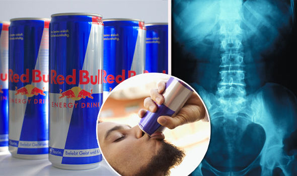 Çfarë i bën trupit tuaj vetëm një kanaçe Redbull?