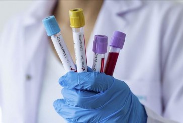 Rahovec, 35 të vdekur nga fillimi i pandemisë – 99 raste aktive me coronavirus