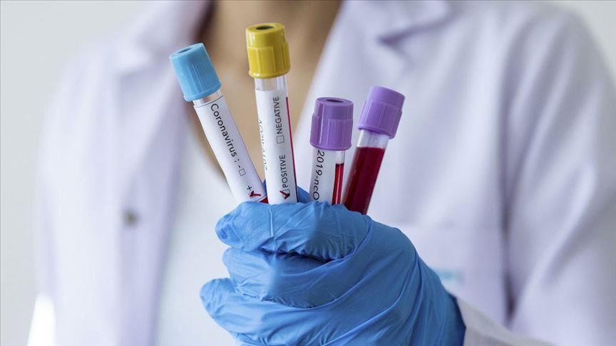 Rahovec, 35 të vdekur nga fillimi i pandemisë – 99 raste aktive me coronavirus